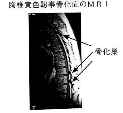 22q11 2欠失症候群 指定難病２０３ 難病情報センター